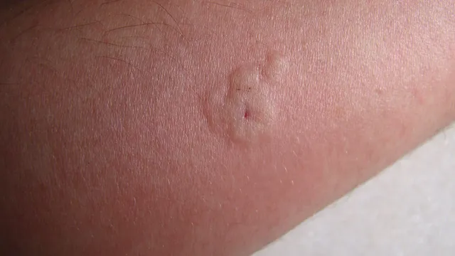 Brumbasse bider – illustrativt nærbillede