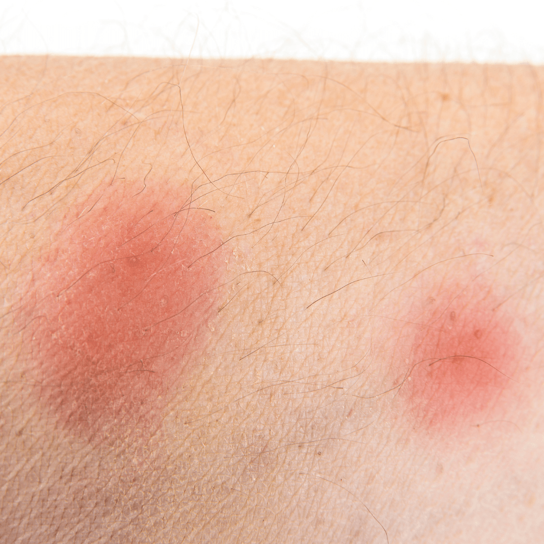 Loppebid – mange små røde prikker